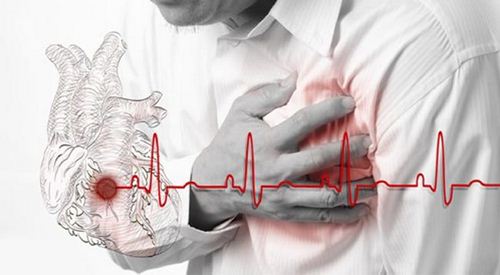 تطوّر طبي جديد قد يوقف النوبة القلبية أثناء حدوثها