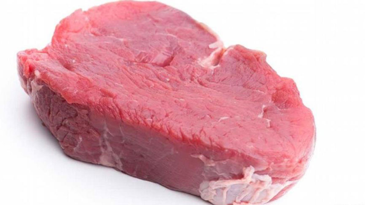 ما هو مرض الهيموسيستين يوريا؟