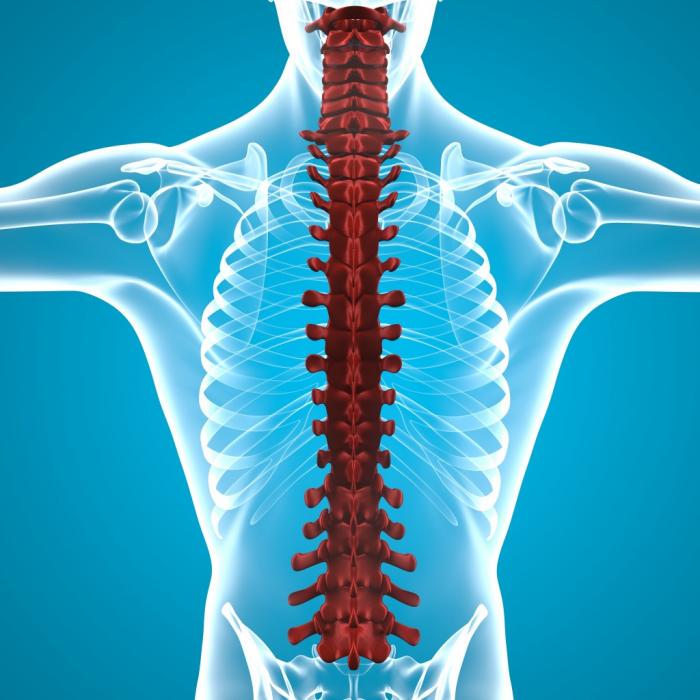 التهاب النخاع الشوكي الرخو الحاد (Acute Flaccid Myelitis)