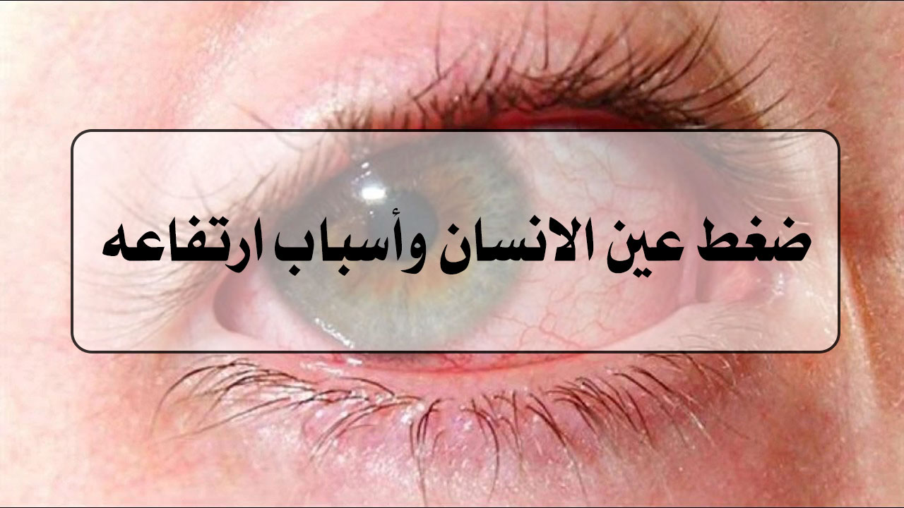 ضغط عين الانسان وأسباب ارتفاعه